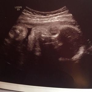 Meet your Posher, Reneê